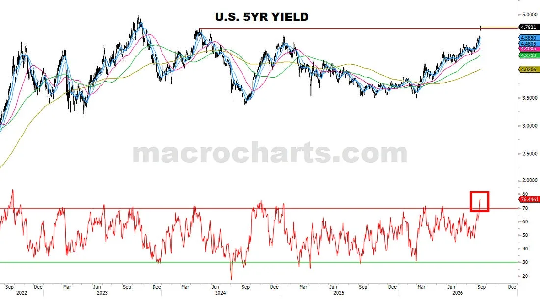 10-year yield